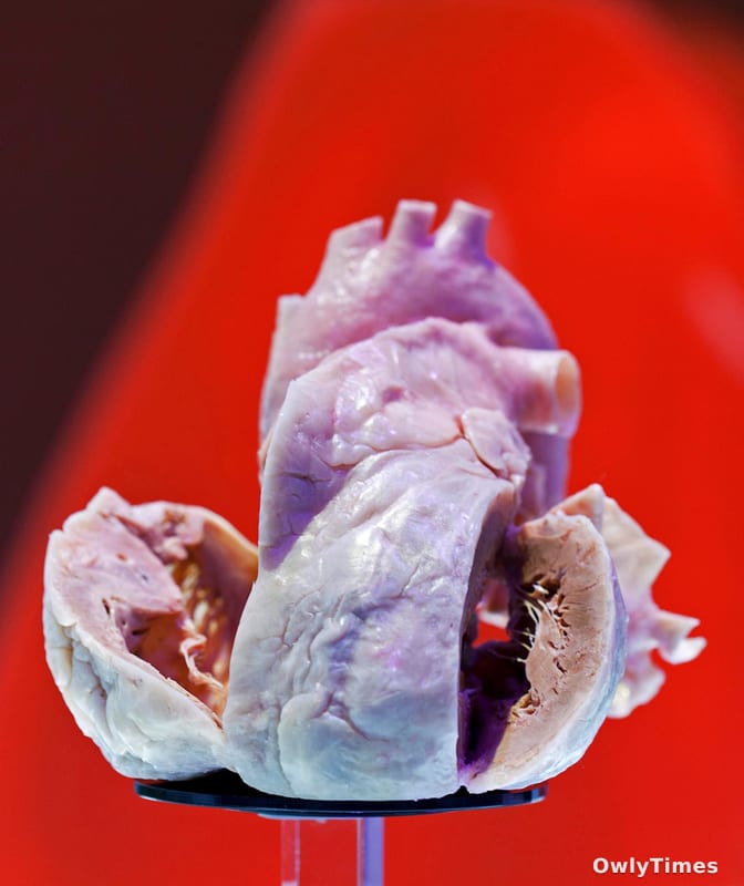 Young Men's Hearts: Early CVD Risk Signals a Shift – Analysis