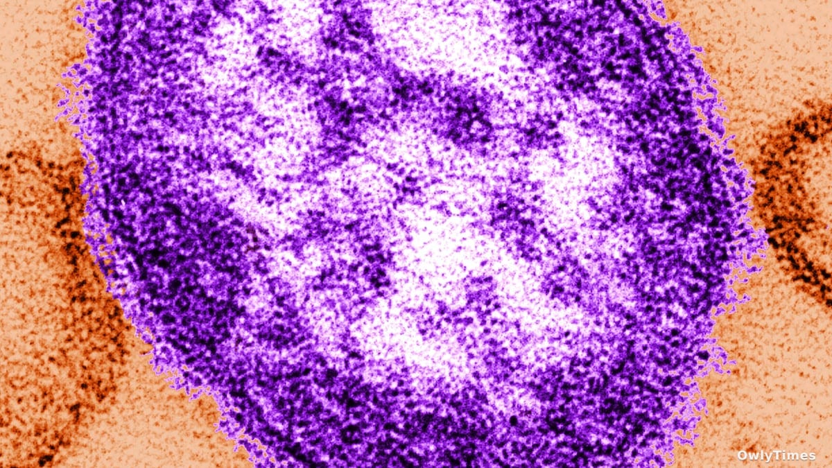 Oregon Measles Case: Immunity Shift Signals Rising Risk