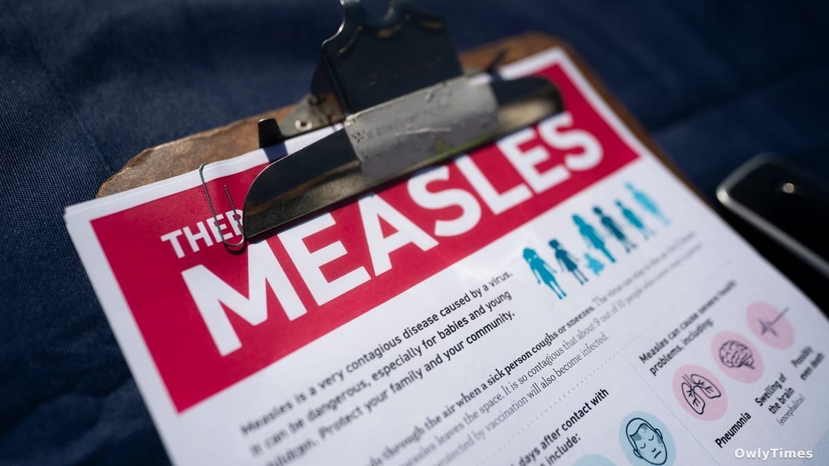 Oregon Measles Exposure: A Public Health System Strain?