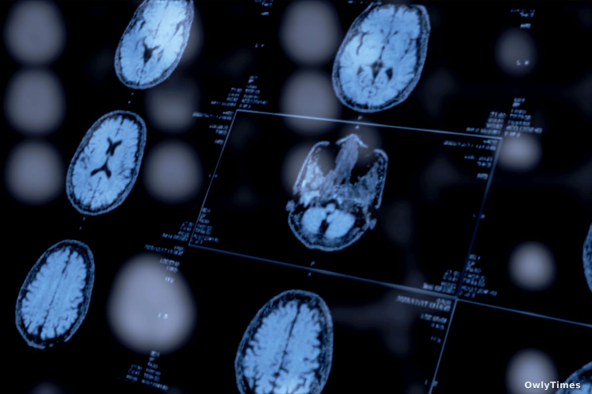 Mental Health: Biomarkers Signal a Diagnostic Shift