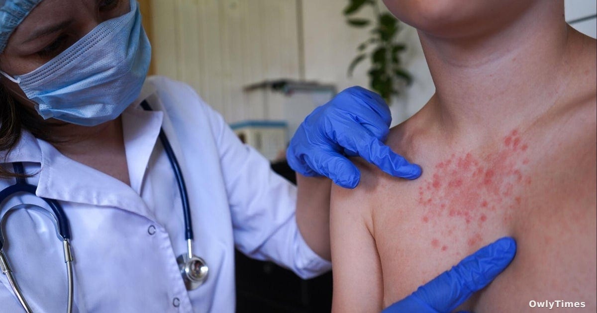 Colorado Measles: Broomfield Cases Signal Immunity Shift