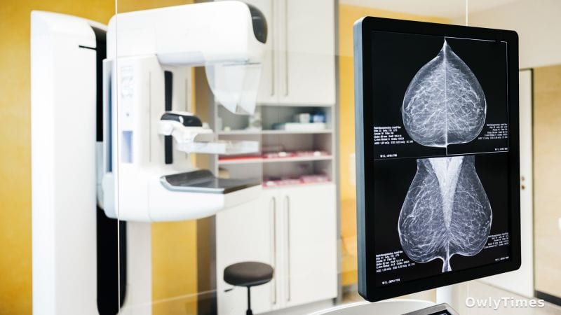 Breast Cancer: Survival Gap Signals Global Health Stakes