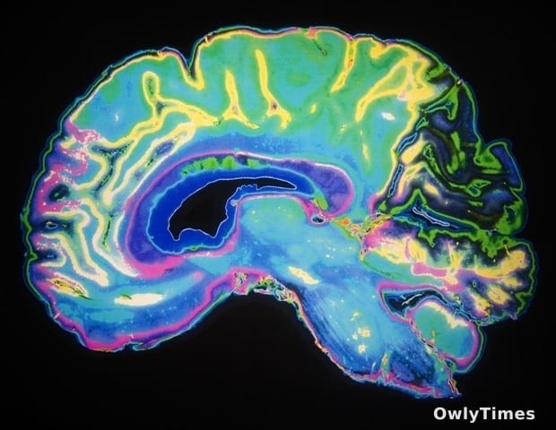 AI Models Analyze Gut Microbiome Data to Diagnose Mental Disorders