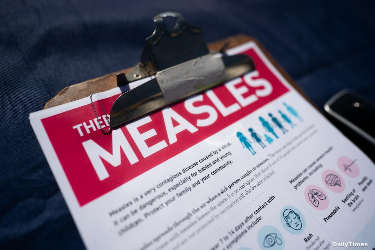2nd Measles Case in Nassau; Health Warns of Restaurant Exposure
