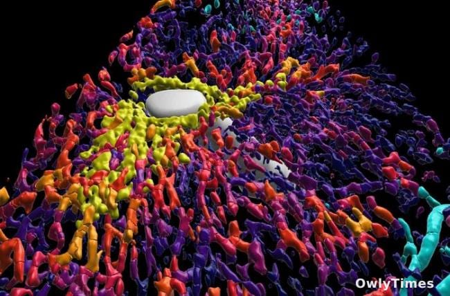 3D Liver Models: Analysis of Cirrhosis's Hidden Impact