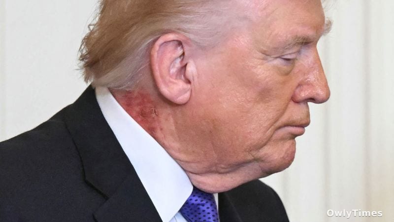 Trump Health: Subtle Shifts Signal Aging Concerns – Analysis