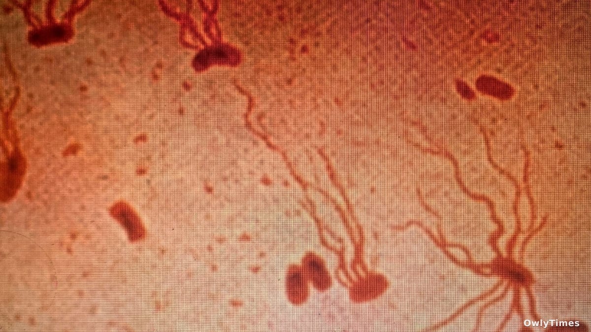 Typhoid's Rising Resistance: A Global Health Stakes Analysis