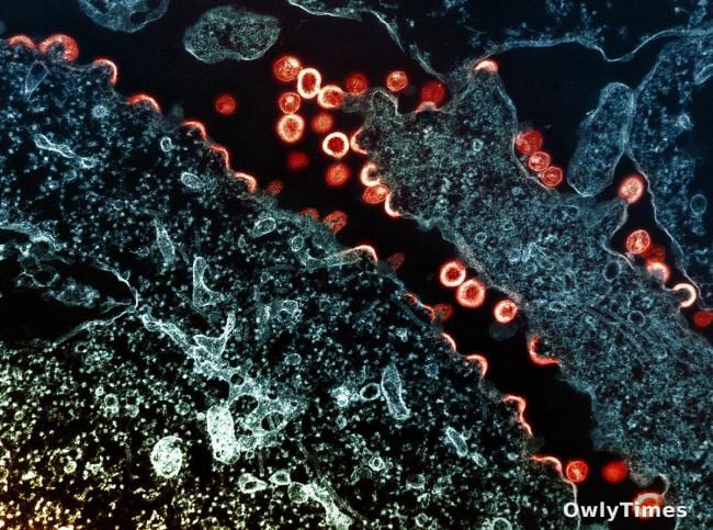 HIV's Delivery Problem: Kenya/Uganda Trial Signals Shift